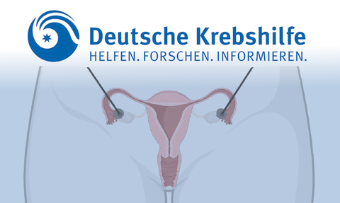 Krebshilfeprojekt Figure