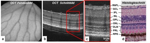 OCT Netzhaut