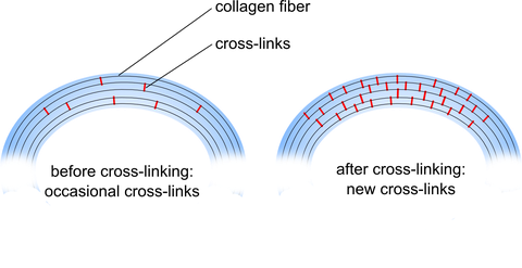 collagen cross-linking