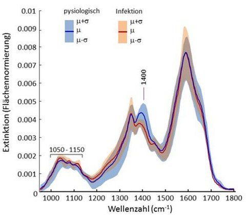 Das Bild zeigt IR-Spektren von physiologischen CSF Proben und CSF mit Infektion.