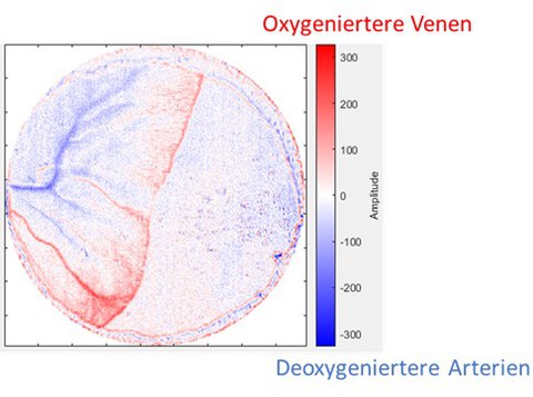 Das Bild zeigt die Segmentierung von Blutgefäßen anhand des Oxygenierungsgrades.