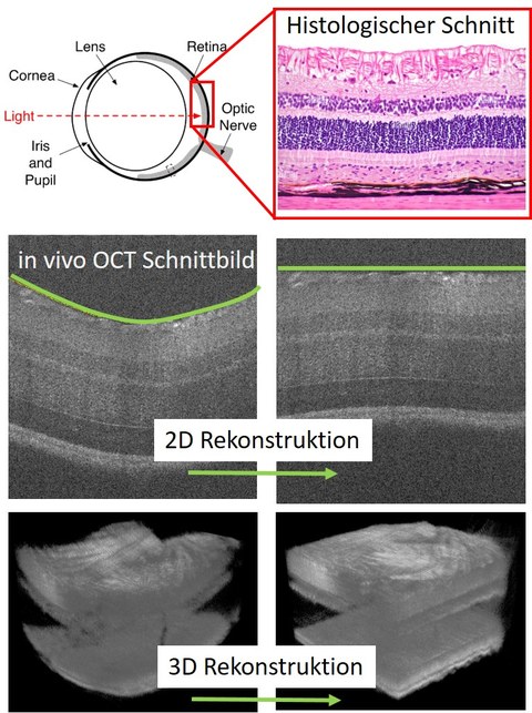 Das Bild zeigt einen histologischen Schnitt sowie OCT-Aufnahmen der murinen Retina.