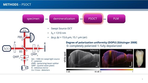 Das Bild zeigt eine Präsentationsfolie zu den Methoden der PS-OCT.