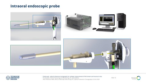 Das Bild zeigt eine Präsentationsfolie zum Thema einer intraoralen endoskopischen Probe.