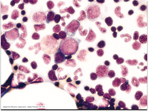 Bone Marrow Image