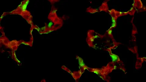 Alveolar epithelial cell