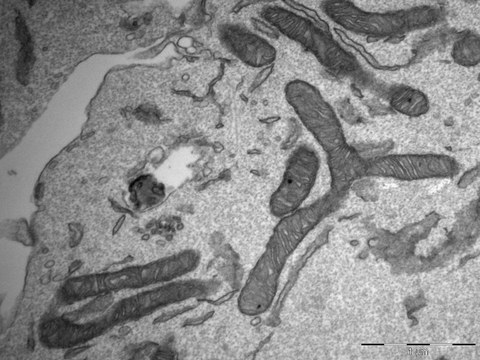 Fig. 1: EM picture of mitochondria in endothelial cells. Scale 1 µm.