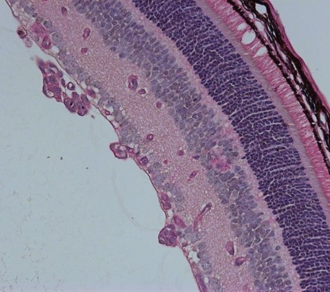 Fig. 4: PAS-stained retinal cross section of the mouse with pathological vessels. 