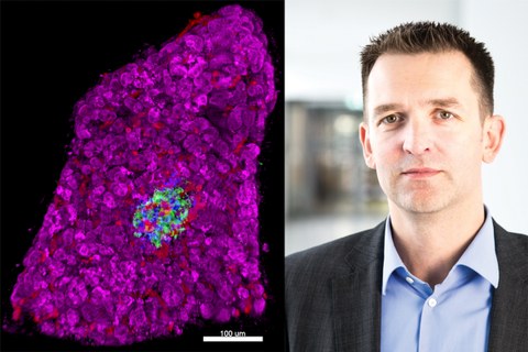 Links: 3D-Morphometrie einer pankreatischen Insel innerhalb eines humanen Gewebeschnittes. Rechts: Prof. Stephan Speier 