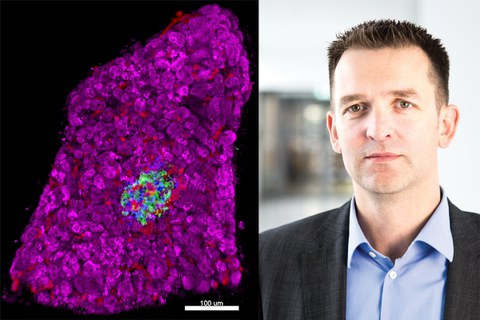 Left: 3D morphometry of an islet within a human pancreas tissue slice. Right: Prof. Stephan Speier 