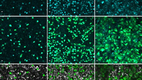 Immunofluoreszenzbilder zeigen das Gen NEUROG3 in Cyan in menschlichen Zellen der Bauchspeicheldrüse. 