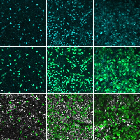 Immunofluorescence images showing the gene NEUROG3 in cyan in human pancreatic cells.
