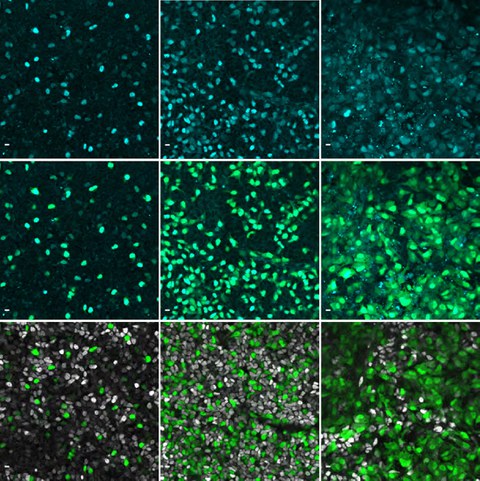 Immunofluoreszenzbilder zeigen das Gen NEUROG3 in Cyan in menschlichen Zellen der Bauchspeicheldrüse. 