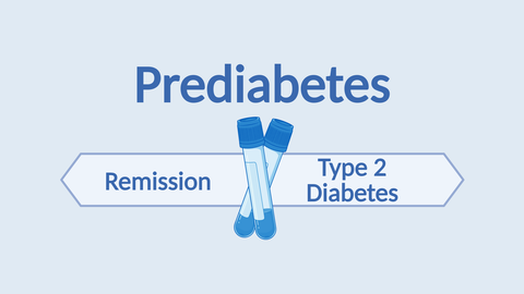 Auf einem hellblauen Untergrund sind zwei schematische Blutplasmaröhrchen abgebildet, die sich kreuzen. Darüber steht das Wort "Prediabetes". Darunter zeigen zwei Pfeilboxen in unterschiedliche Richtung, beschriftet mit "Remission" und "Type 2 Diabetes"