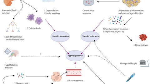 Faktoren, die zur Entwicklung oder Verschlimmerung von Diabetes bei Patienten mit SARS-CoV-2-Infektion beitragen.