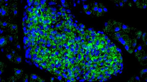 Islet of Langerhans with the Wnt4 staining in green and the cell nuclei in blue.