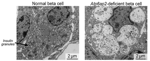 Vergleich normaler Betazellen mit Atp6ap2-defizienten Betazellen