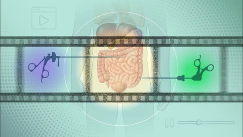 Illustration der menschlichen Verdauungsorgane in der Mitte, links und rechts davon chirurgische Tools.