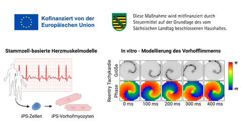 Links: Abbildung von aus iPS‑Zellen gewonnenen Vorhofmyozyten, die Veränderungen bei Vorhofflimmern darstellen. Rechts: Diagramm der elektrischen Aktivität der Zellen, das rhythmische Unregelmäßigkeiten in einem in‑vitro‑Modell von Vorhofflimmern zeigt.