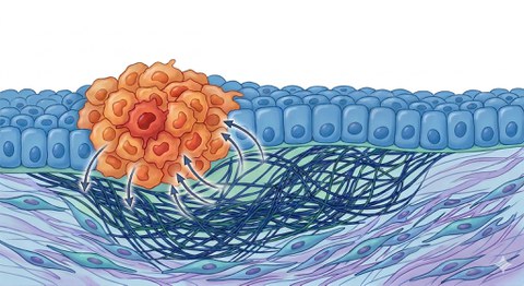 Schematic representation of a precancerous niche featuring a larger group of altered cells in the epithelium (upper layer) and bidirectional signaling to the underlying tissue.