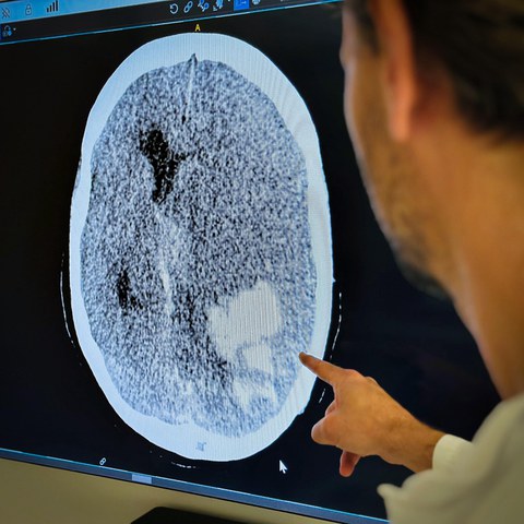 Prüfung einer Organspende