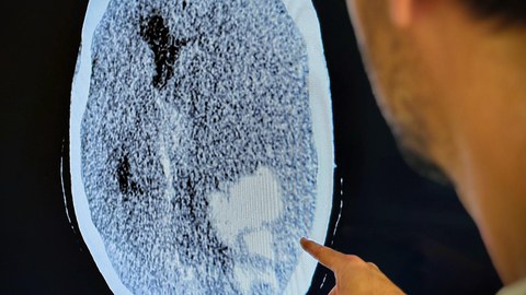 Prüfung einer Organspende