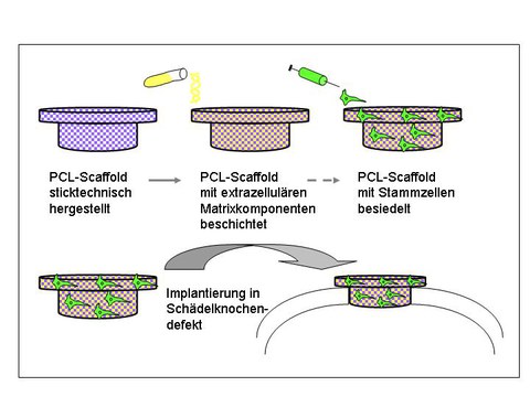 Abbildung 1: Schädelrekonstruktion mittels eines PCL-Scaffolds. Herstellung, Beschichtung,