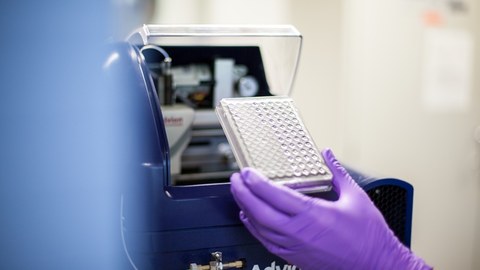 Mit dem Massenspektrometer identifizierten die Wissenschaftler über 200 verschiedene Lipide aus dem Blutplasma anhand deren Masse und Ladung.