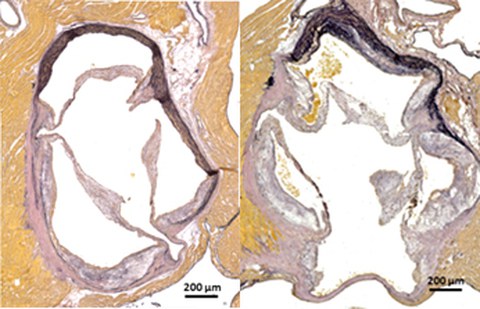 Histologische Färbung der Aortenwurzel zeigt rechts die verstärkte Plaquebildung ohne Nox4