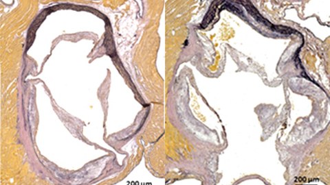 Histologische Färbung der Aortenwurzel zeigt rechts die verstärkte Plaquebildung ohne Nox4