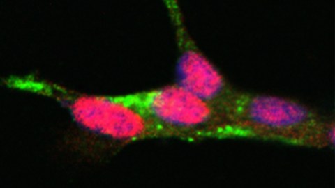 Validierung von PDX1, einem Transkriptionsfaktor der sich oberhalb der T2D-Inselsignaturgene befindet. Co-Immunofärbung für Insulin (grün) und PDX1 (rot) in humanen EndoC-βH1 Zellen. Zellkerne sind mit DAPI (blau) gegengefärbt.