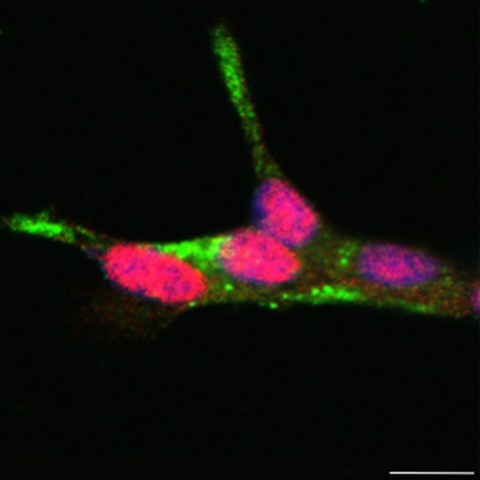 Validierung von PDX1, einem Transkriptionsfaktor der sich oberhalb der T2D-Inselsignaturgene befindet. Co-Immunofärbung für Insulin (grün) und PDX1 (rot) in humanen EndoC-βH1 Zellen. Zellkerne sind mit DAPI (blau) gegengefärbt.