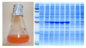 Praktikum Heterologe Genexpression