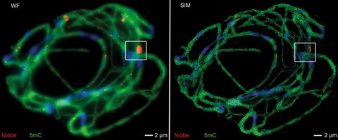 Chromosomal localization and DNA methylation of satellite DNAs on sugar beet chromosomes detected after ﬂuorescence in situ hybridization and immunostaining by wide-ﬁeld (WF) epiﬂuorescence and structured illumination microscopy (SIM).