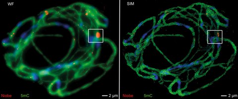 Chromosomal localization and DNA methylation of satellite DNAs on sugar beet chromosomes detected after ﬂuorescence in situ hybridization and immunostaining by wide-ﬁeld (WF) epiﬂuorescence and structured illumination microscopy (SIM).