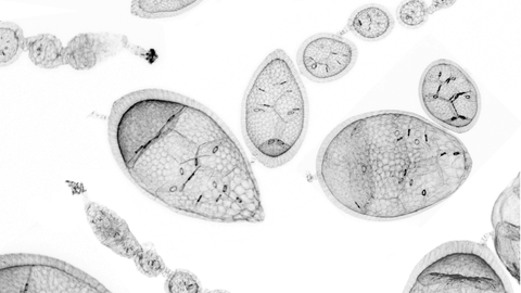 F-Aktin Färbung von Drosophila Ovariolen mit Eikammern in verschiedenen Stadien. Die Herunterregulierung von jeweils einer Hauptkomponente der Basallamina führt zur Veränderung der mechanischen Eigenschaften und zur Änderung der Form der Eikammern.