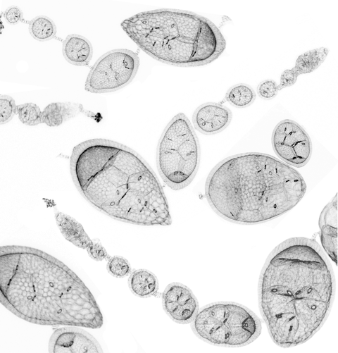 F-Aktin Färbung von Drosophila Ovariolen mit Eikammern in verschiedenen Stadien. Die Herunterregulierung von jeweils einer Hauptkomponente der Basallamina führt zur Veränderung der mechanischen Eigenschaften und zur Änderung der Form der Eikammern.