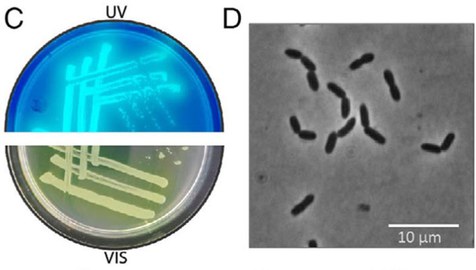 Man sieht fluoreszierende Kolonien von Mikroorganismen und ein Bild der Mikroorganismen unter dem Mikroskop.