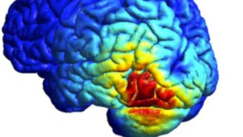 A model of the electromagnetic field in the brain depicts the spatial distribution of activity through different colors and intensities