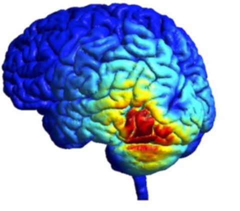 Ein Modell des elektromagnetischen Feldes im Gehirn zeigt die räumliche Verteilung von Aktivität durch unterschiedliche Farben und Intensitäten
