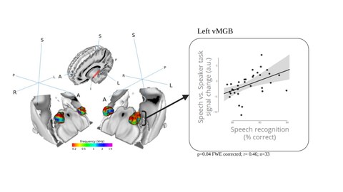 Die Abbildung zeigt links ein menschliches Gehirn in dem der auditorische Thalamus zu sehen ist.Rechts daneben ist ein Diagramm abgebildet welches zeigt,dass eine höhere Aktivierung im auditorischen Thalamus eine bessere Spracherkennungsfähigkeit bedeutet