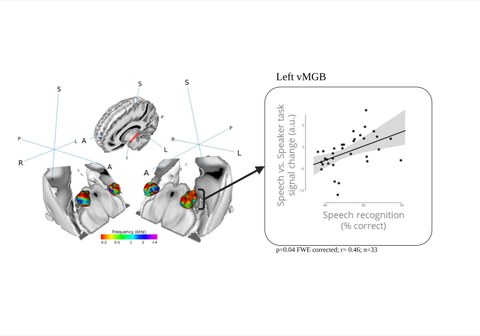 Die Abbildung zeigt links ein menschliches Gehirn in dem der auditorische Thalamus zu sehen ist.Rechts daneben ist ein Diagramm abgebildet welches zeigt,dass eine höhere Aktivierung im auditorischen Thalamus eine bessere Spracherkennungsfähigkeit bedeutet