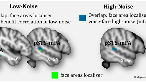 Brain responses in visual face areas (FFA, pSTS-mFA) during voice-identity recognition for face-learned speakers in different levels of auditory noise.
