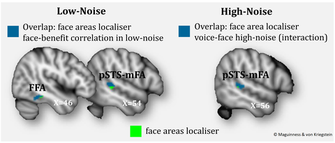 Brain responses in visual face areas (FFA, pSTS-mFA) during voice-identity recognition for face-learned speakers in different levels of auditory noise.