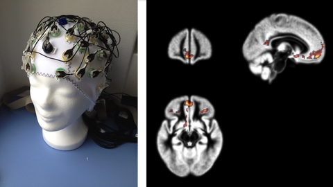 EEG Kappe und Bilder des Gehirns, durch mit der Methode der funktionellen magnetischen resonanstomograpie gemacht wurden