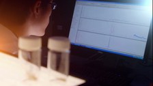Auswertung am Computer