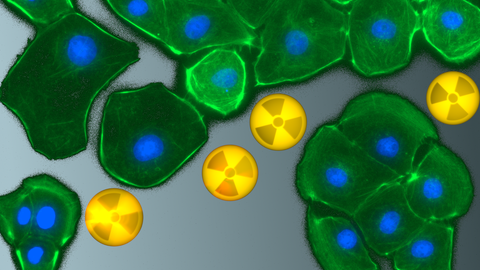 Fluoreszenzmikroskopische Aufnahme von Rattennierenzellen nach Behandlung mit radioaktiven Schwermetallionen.