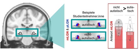 Abbildung Schnitt durch ein Gehirnbild