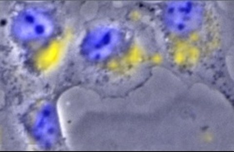Verteilung von Europium(III) innerhalb einer Rattennierenzelle, erstmalig sichtbar gemacht mittels chemischer Mikroskopie, eine einzigartige Kopplung von Raman-Mikroskopie und Lumineszenzspektroskopie. Blau: Zellkerne, gelb: Europium.