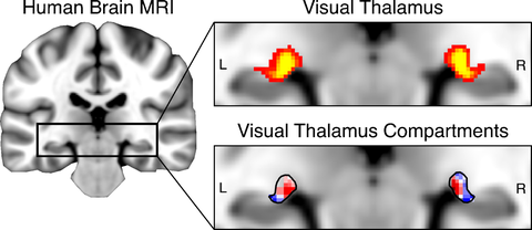 MRI Image of the brain.